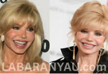 Loni Anderson Biography, Wikipedia, Age, Early Life, Education, Career, Family, Spouse, Personal Life, Filmography, Television Films, Net Worth, Facts, Legacy